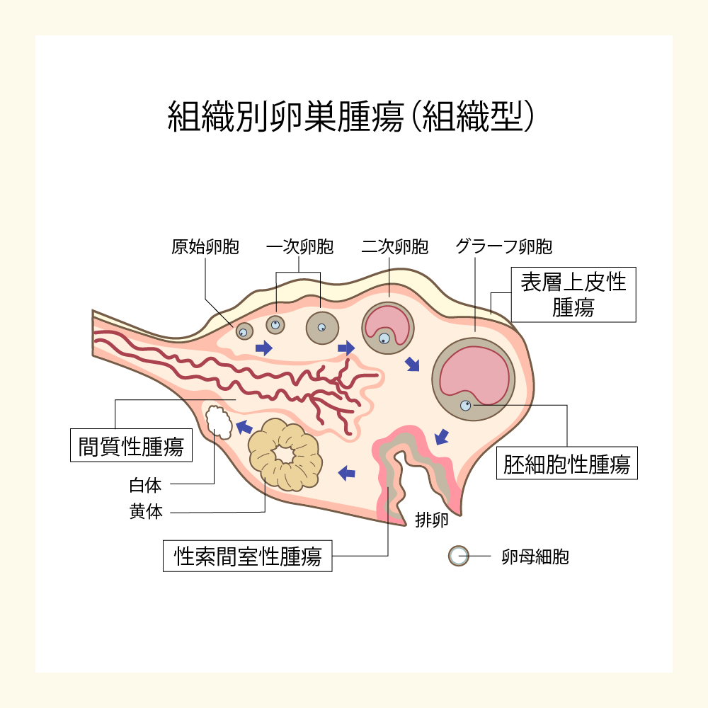 卵巣痛み 原因 – 卵巣の痛み どこ : 卵巣痛とは?症状・原因・治療・病院の診療科目 – AXBWFW